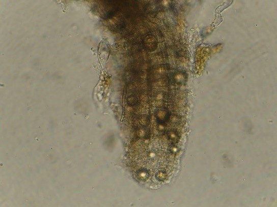 Bào tử của bệnh Pythium