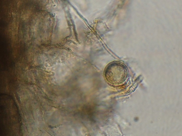 Bào tử của nấm vảy đỏ