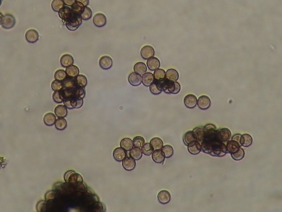 Bào tử nấm mốc bụi