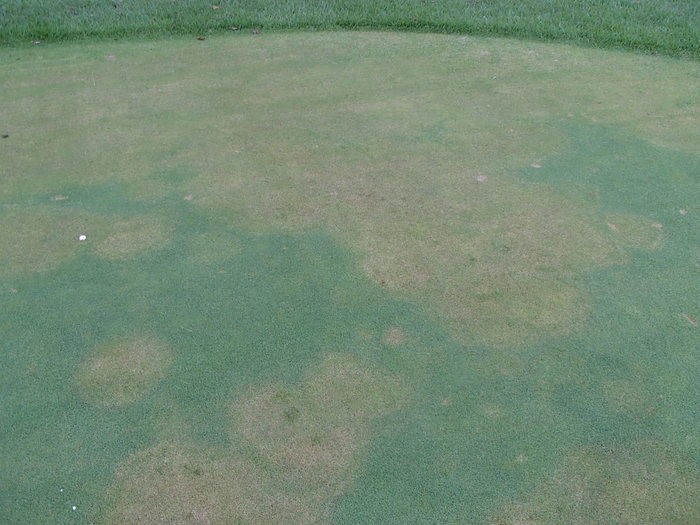 Các mảng màu nâu với các triệu chứng tiến triển và hợp nhất