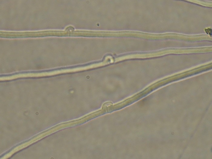 Sợi nấm Basidiomycete với các kết nối thưa thớt