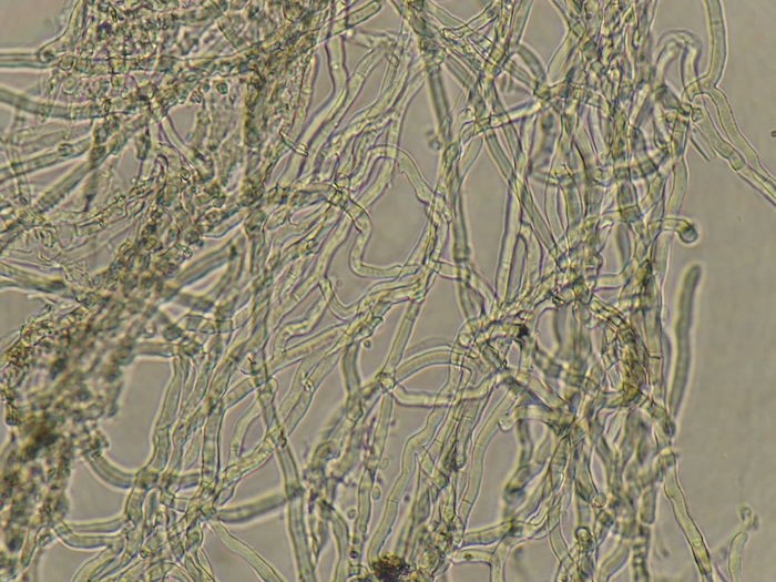 Sợi nấm của nấm Ceratobasidium gramineum (Rhizoctonia grainis AG-DI)