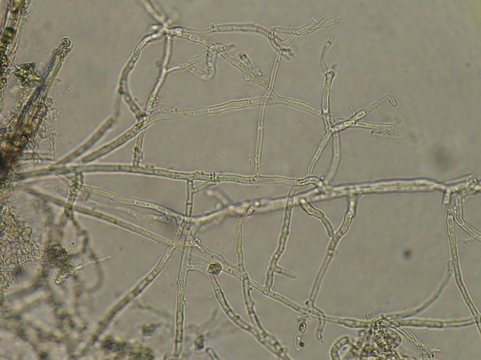 Sợi nấm của nấm mảng nâu