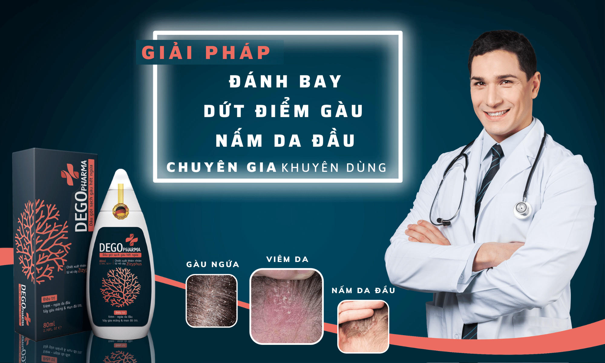 cách điều trị nấm da đầu