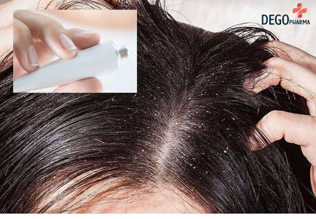 phác đồ điều trị nấm da đầu