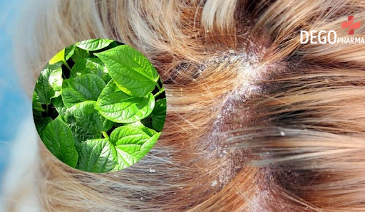 viêm da đầu gây rụng tóc