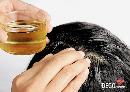 Triệu chứng nấm da đầu