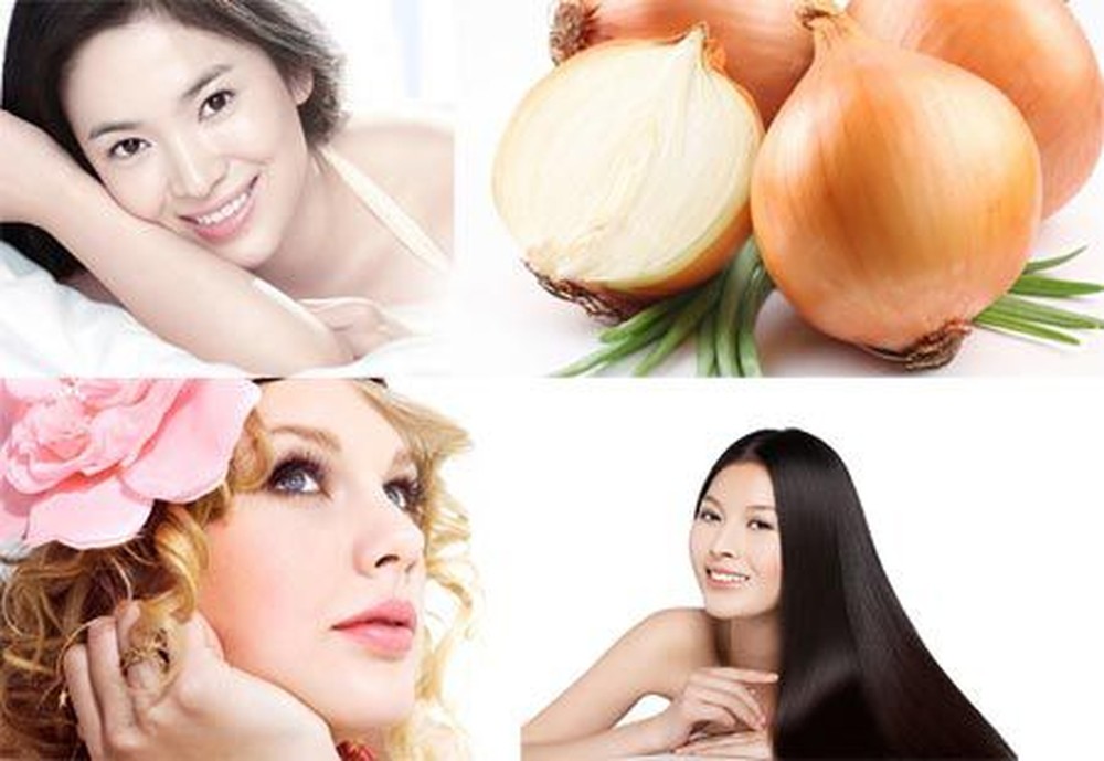 Trị rụng tóc bằng hành tây