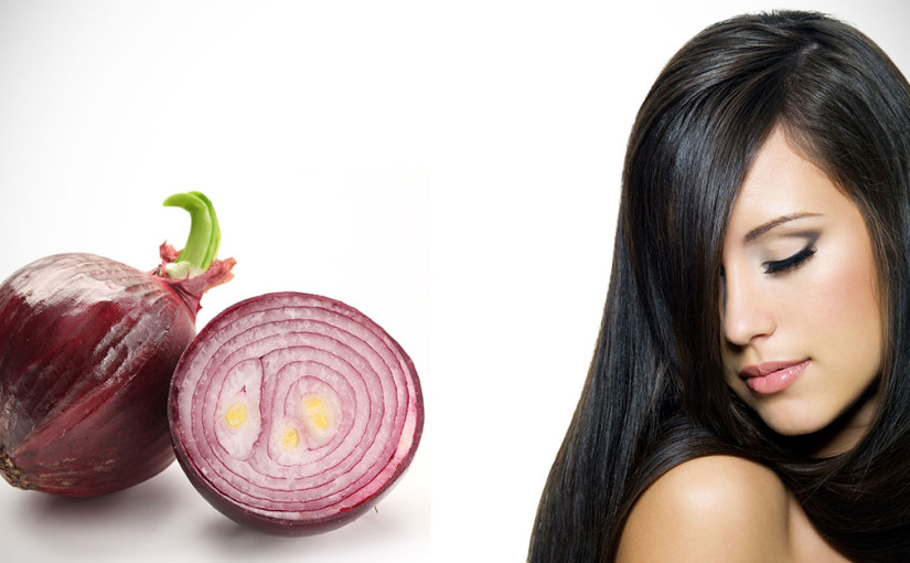Trị rụng tóc bằng hành tây