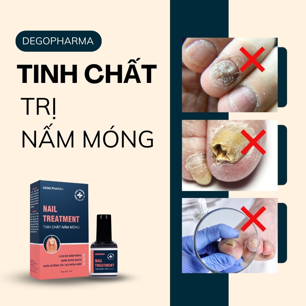 Tác dụng phụ có thể xảy ra khi sử dụng thuốc trị nấm móng tay Dego Pharma