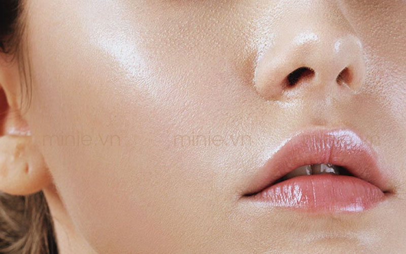 Da nhờn là loại da như thế nào