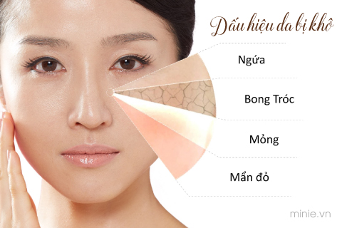 Dấu hiệu da mặt bị khô
