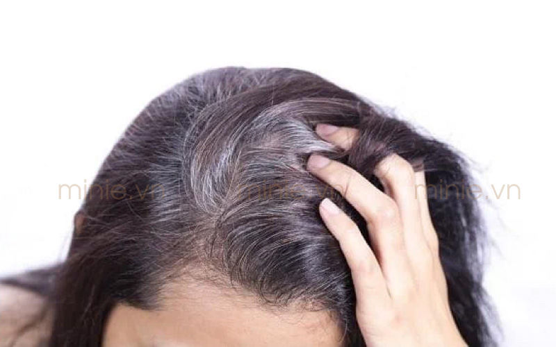 Dấu hiệu lão hóa gây rụng tóc, tóc mỏng và bạc màu