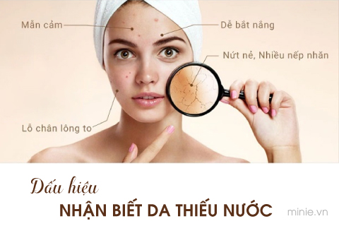 Dấu hiệu nhận biết da thiếu nước | Minie