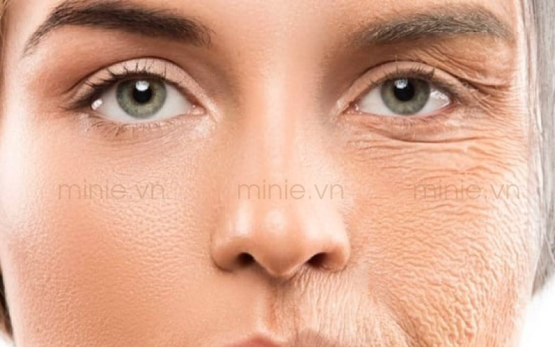 nguyên nhân dẫn đến lão hoá da