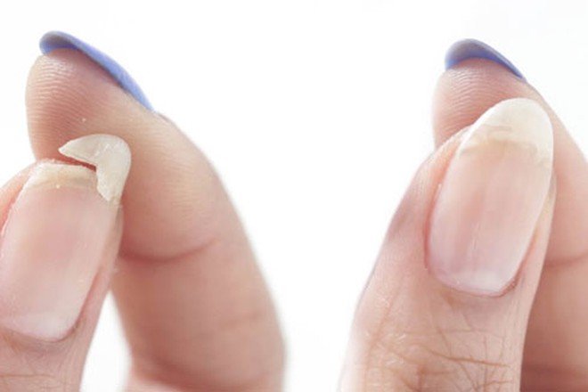 Móng tay thiếu dinh dưỡng