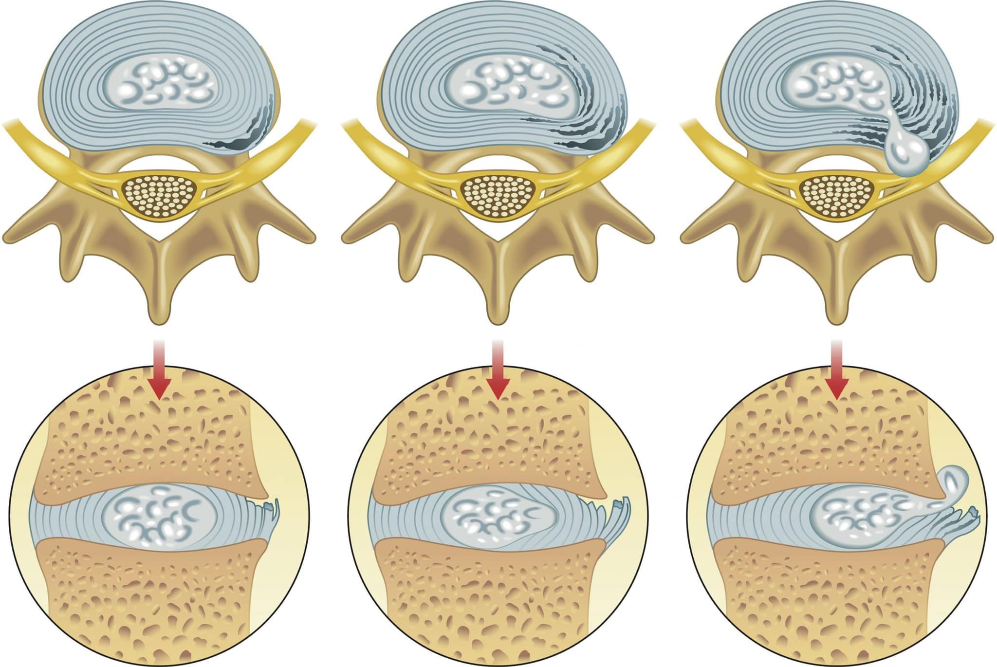 Tư thế ngồi quan trọng thế nào?
