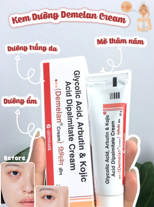 Kem dưỡng trắng Demelan