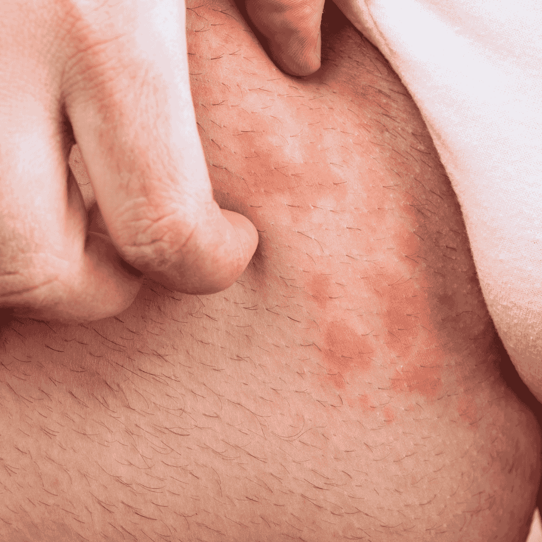 Tầm quan trọng của bảo vệ nguồn nước và ảnh hưởng của nó đến bệnh về da