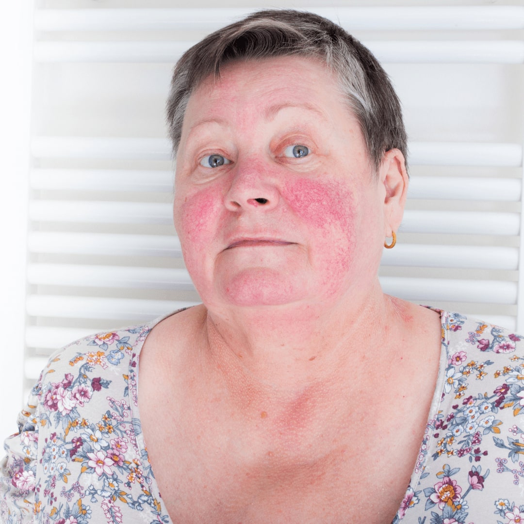 Clo có độc không? Công dụng của Clo trong nước máy