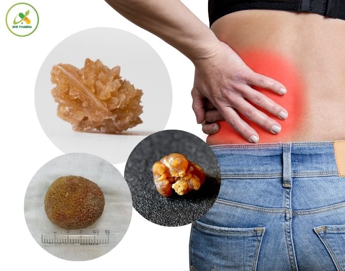 uống canxi lúc nào