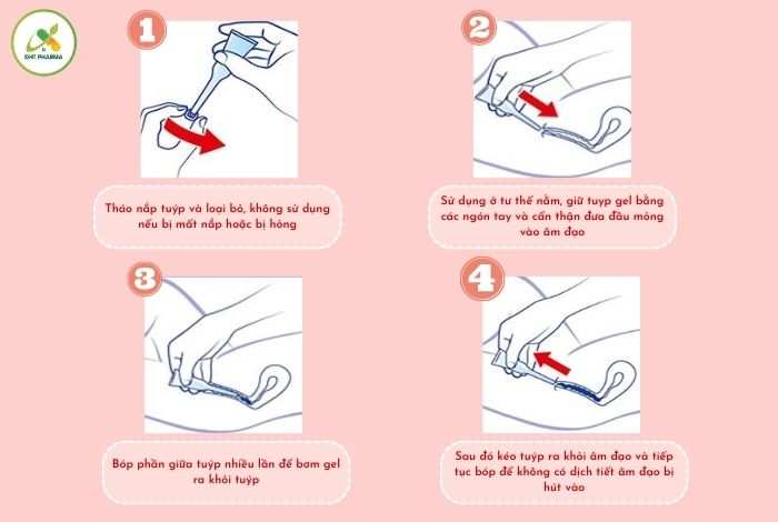 Tuýp tạo môi trường thụ thai Ritex