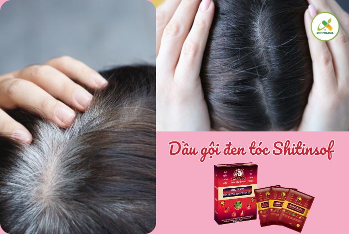 dầu gội đen tóc Shitinsof