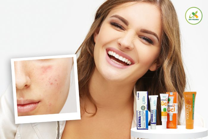 top 5 kem trị thâm mụn