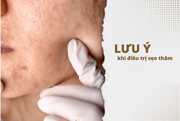 cách trị sẹo thâm