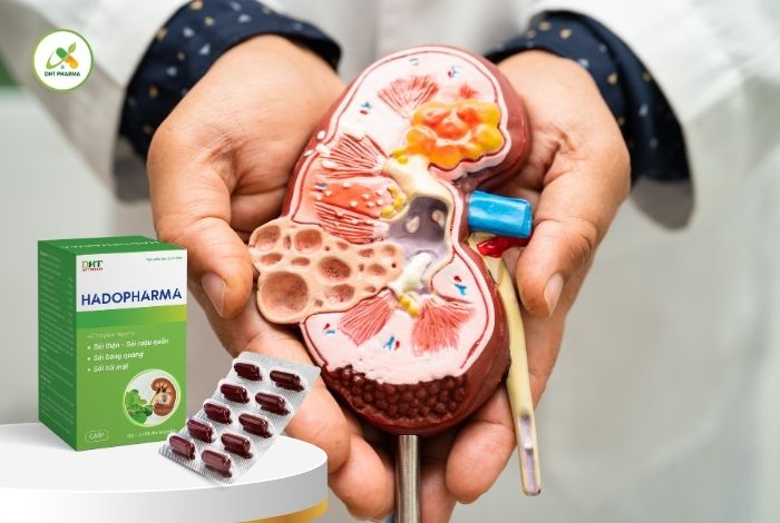 thuốc trị sỏi thận tốt nhất hiện nay