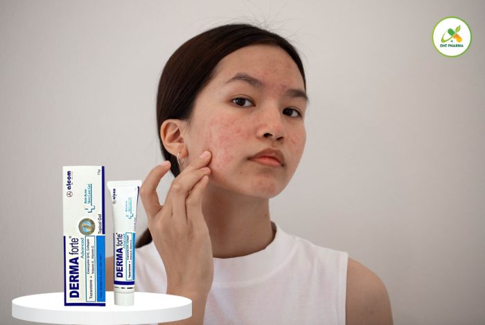 top 5 kem trị thâm mụn