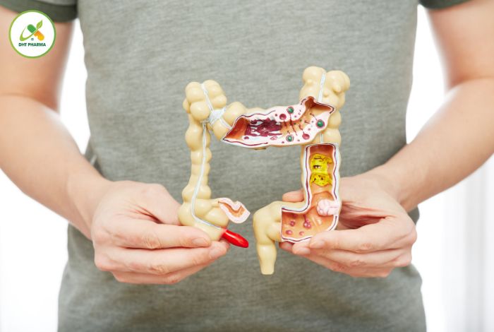 triệu chứng viêm đại tràng