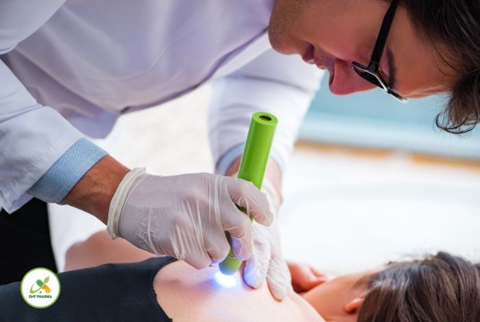 cách trị sẹo thâm