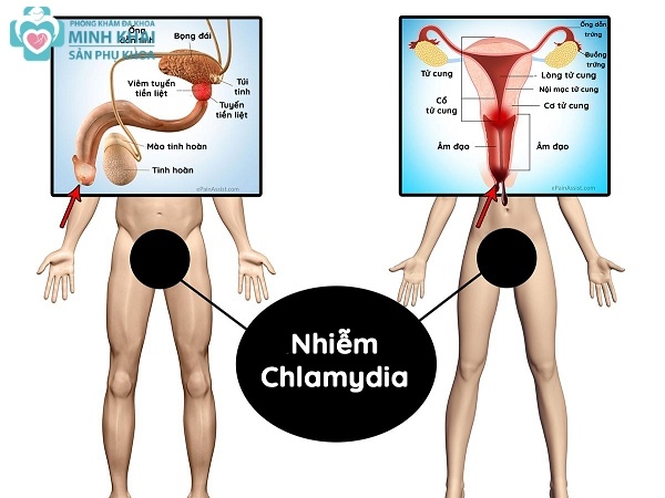 Có nguy cơ cao mắc các bệnh lý khác