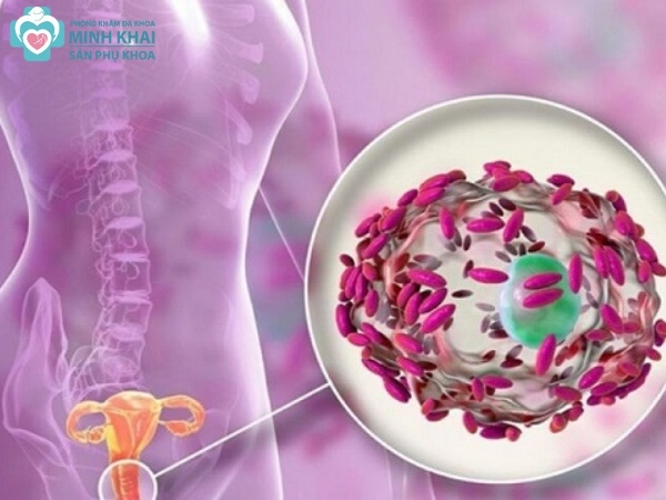 Trichomonas là gì?