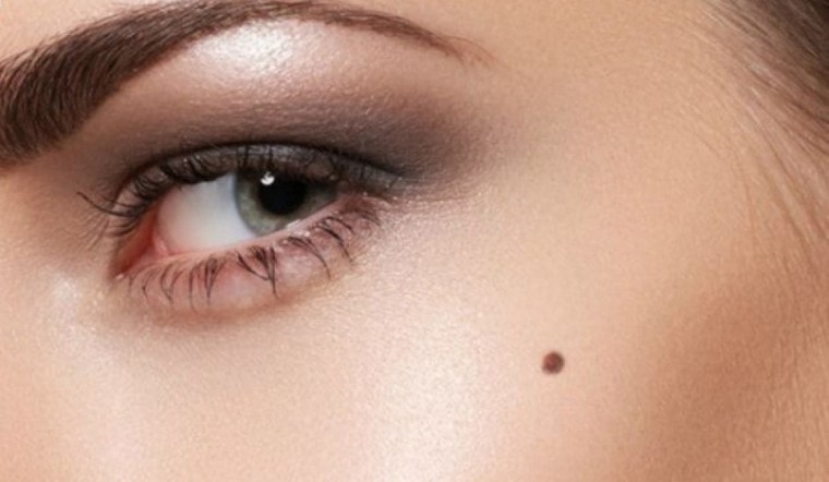 vi tri not ruoi tren mat nu