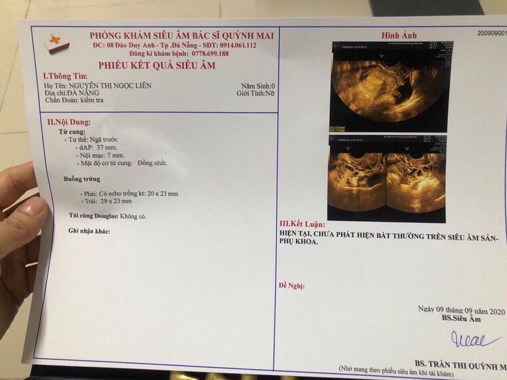 Chuẩn bị đồ khi đi khám thai