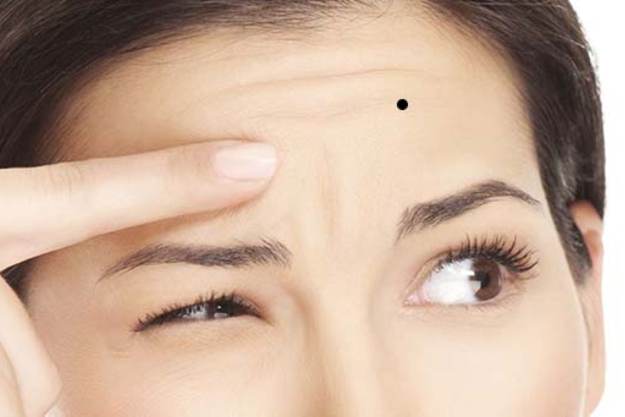 vị trí nốt ruồi trên mặt nữ