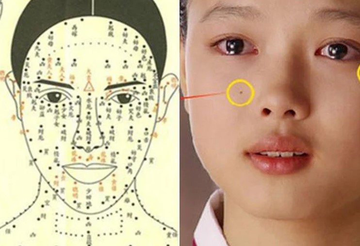 vị trí nốt ruồi trên mặt nữ