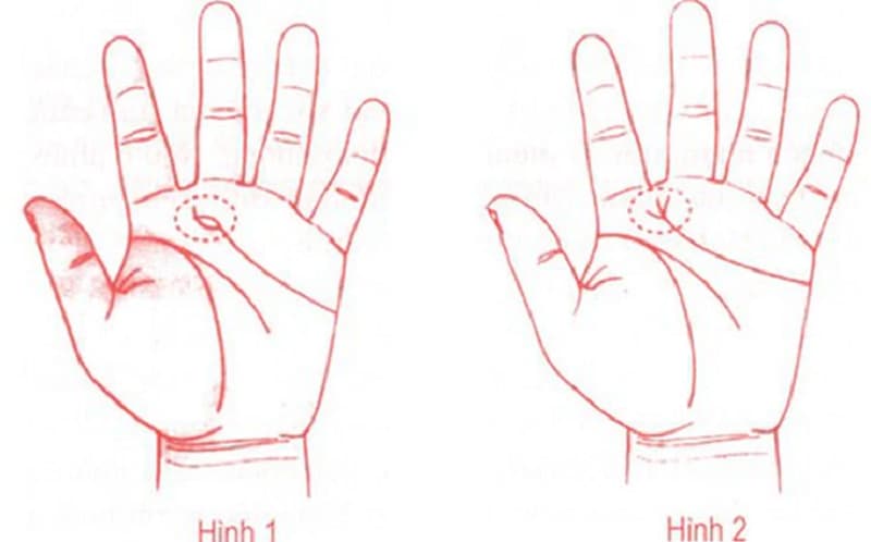 Đường sinh đạo rẽ nhánh còn là dấu hiệu của sự thay đổi về địa điểm sống