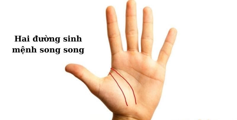 Lòng bàn tay của bạn có hai đường sinh đạo thay vì một đường