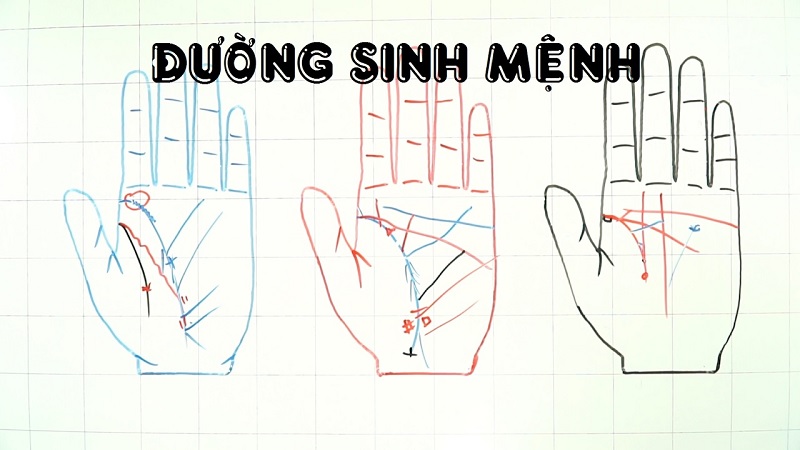 Đường chỉ tay sinh mệnh có thể bị ảnh hưởng bởi yếu tố di truyền
