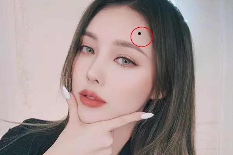 Ý nghĩa của các nốt ruồi ở từng vị trí trên khuôn mặt