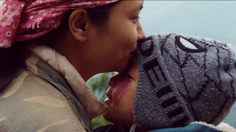 Thông tin về vận mệnh các vết bớt chỉ nên tham khảo