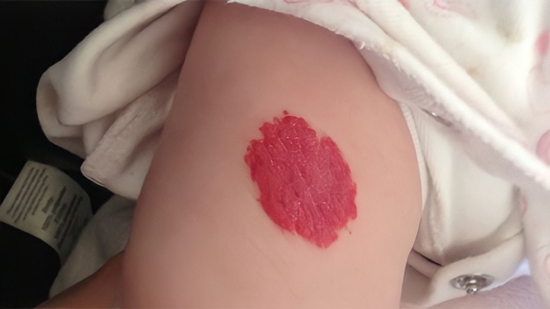 Vết đỏ nằm ở đùi thể hiện là người rất bản lĩnh