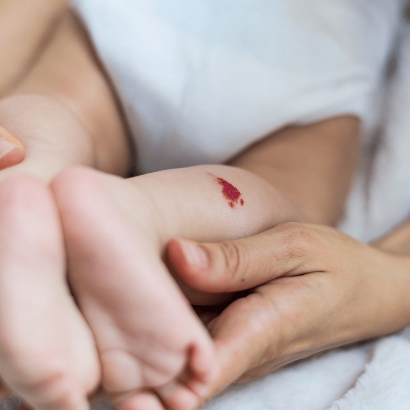 Vết đỏ ngay chân sẽ giúp bạn ngày càng mạnh mẽ