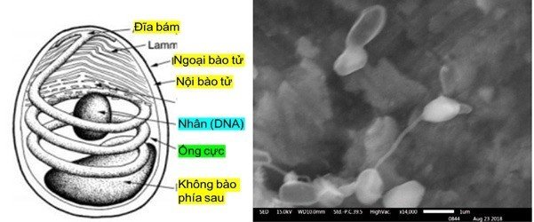 Ảnh cấu tạo của EHP (bên trái), vi bào tử trùng đang phát triển (bên phải)