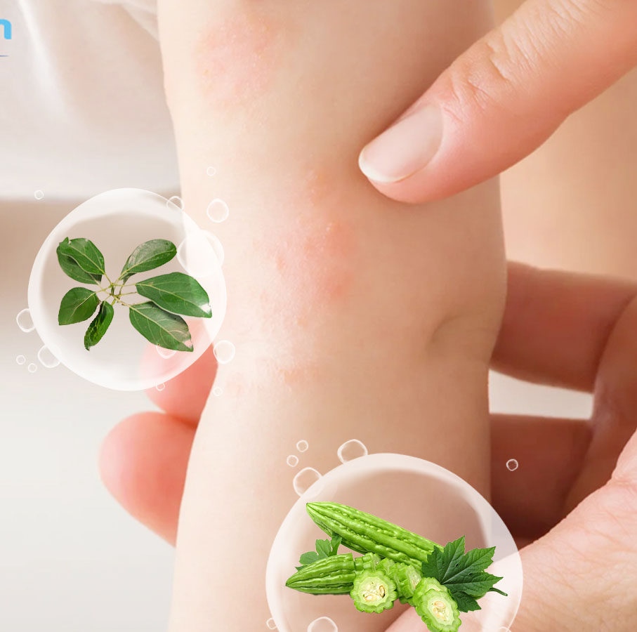 Cách trị rôm sảy cho bé an toàn bằng các loại lá tắm dân gian