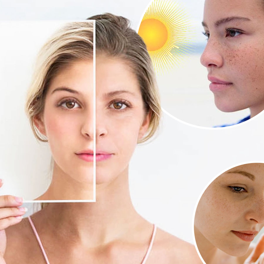Dấu hiệu lão hóa da sớm do tác động của tia UV từ ánh nắng mặt trời