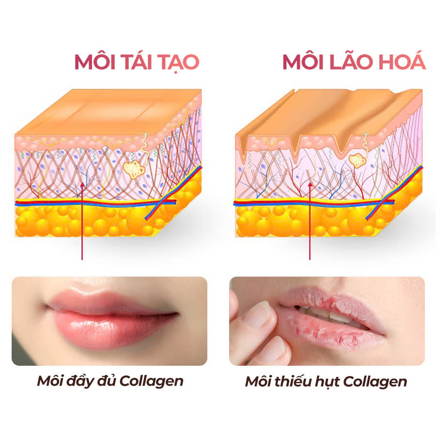 Chiết xuất lựu đỏ kích thích sản sinh collagen, giúp làm đầy rãnh nhăn và căng mọng môi